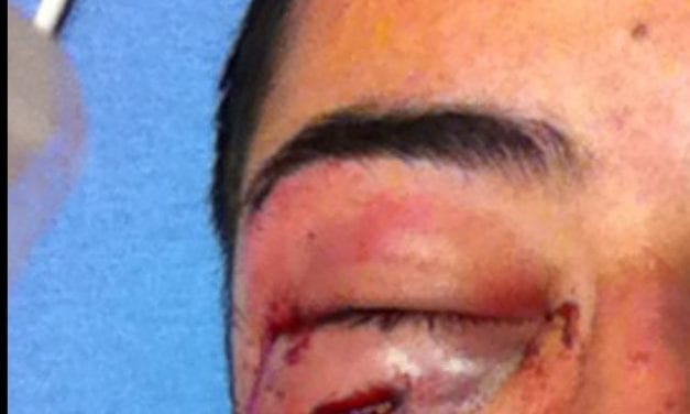 Bartender suffers fractured eye socket in attack outside Rainbow Lounge