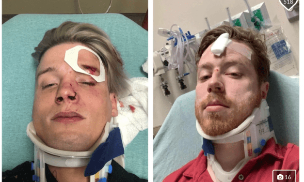 Gay couple attacked in Austin