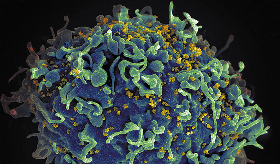 Nearly 40 million living with HIV last year